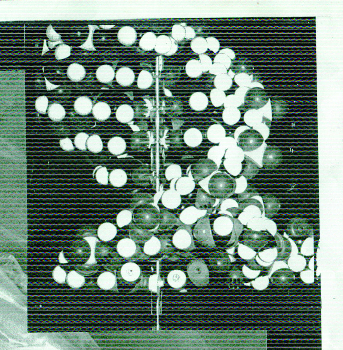 Smegma and L'Autopsie A Révélé Que La Mort Etait Due A L'Autopsie - Transmissions des Fluides